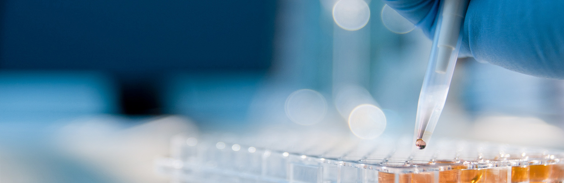 Image: Our 30-year Commitment to HIV/AIDS